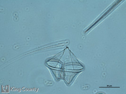 Photo of Protoperidinium conicum/Protoperidinium leonis